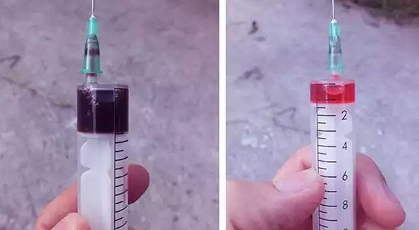 Какую жидкость заливать для гидроусилителя руля и как это делать правильно? Какую жидкость заливать для гидроусилителя руля и как это делать правильно?